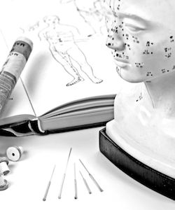 Acupunctuur-naalden-moxa-boek-300-ShSt